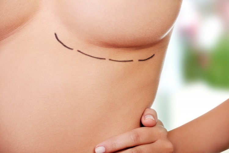 Top Cities With Most Breast Implants in US