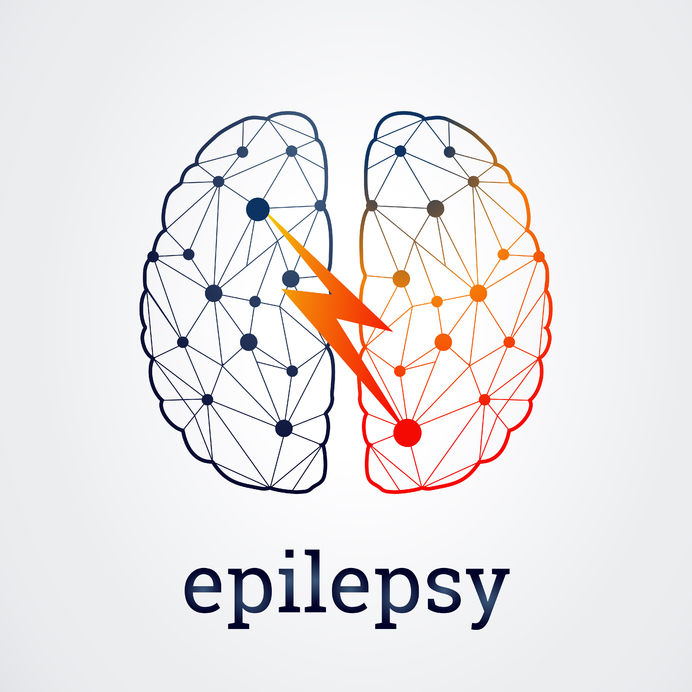 20 Countries With Highest Rate of Epilepsy - Vimarsana News