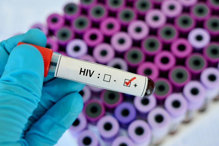 10 Neighborhoods With The Highest HIV Rates in NYC Boroughs