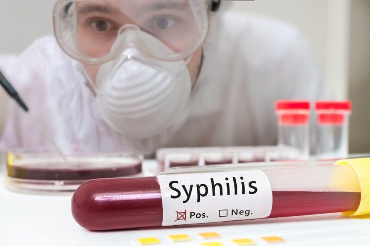 10 Most Sexually Diseased States in America