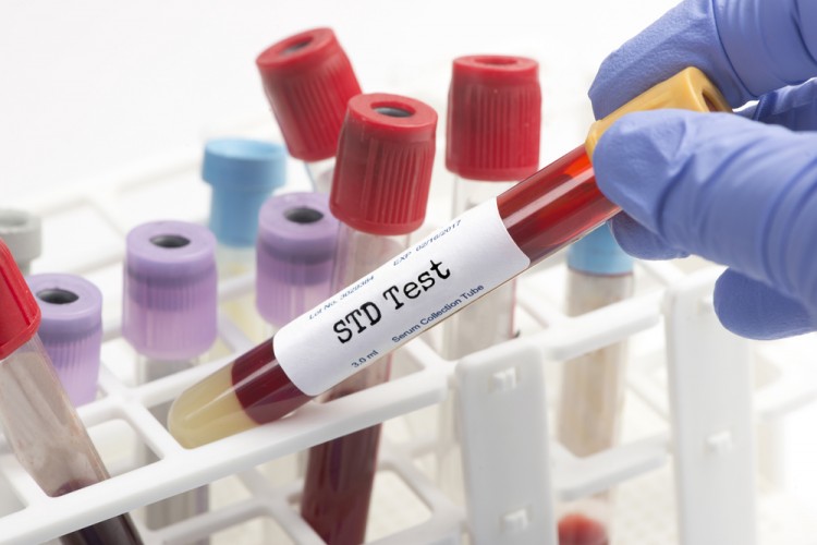 10 Countries With The Highest STD Rates in the Developed World