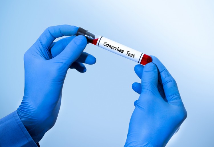 10 Most Sexually Diseased States in America