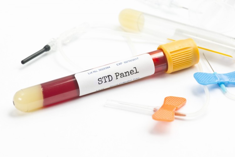 States with the Highest STD Rates in the US in 2018