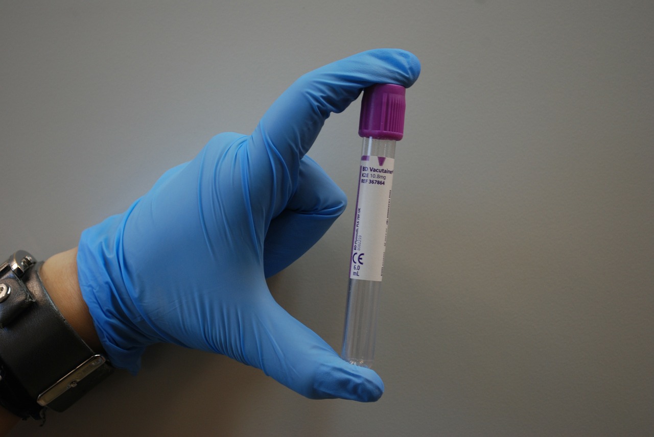 Astera Labs (ALAB) Touches Fresh Peak After "Strong Buy" Reco
