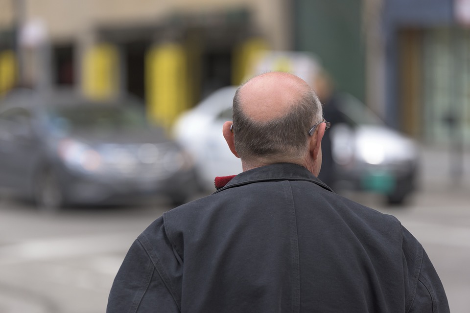 Percentage of Bald Males by Country: 20 Least Bald Countries - Vimarsana News