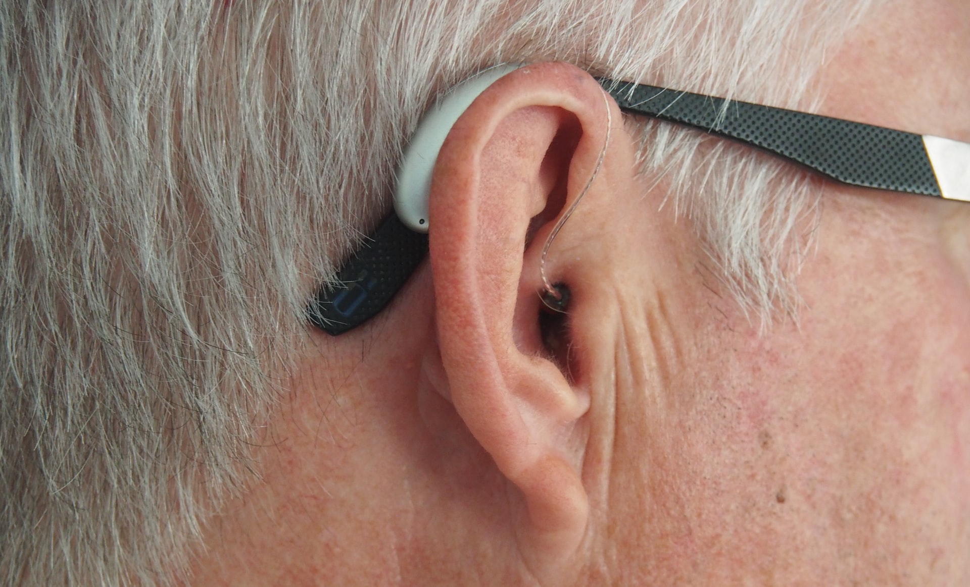 Eargo, Inc. (NASDAQ:EAR) Q4 2022 Earnings Call Transcript - Vimarsana News