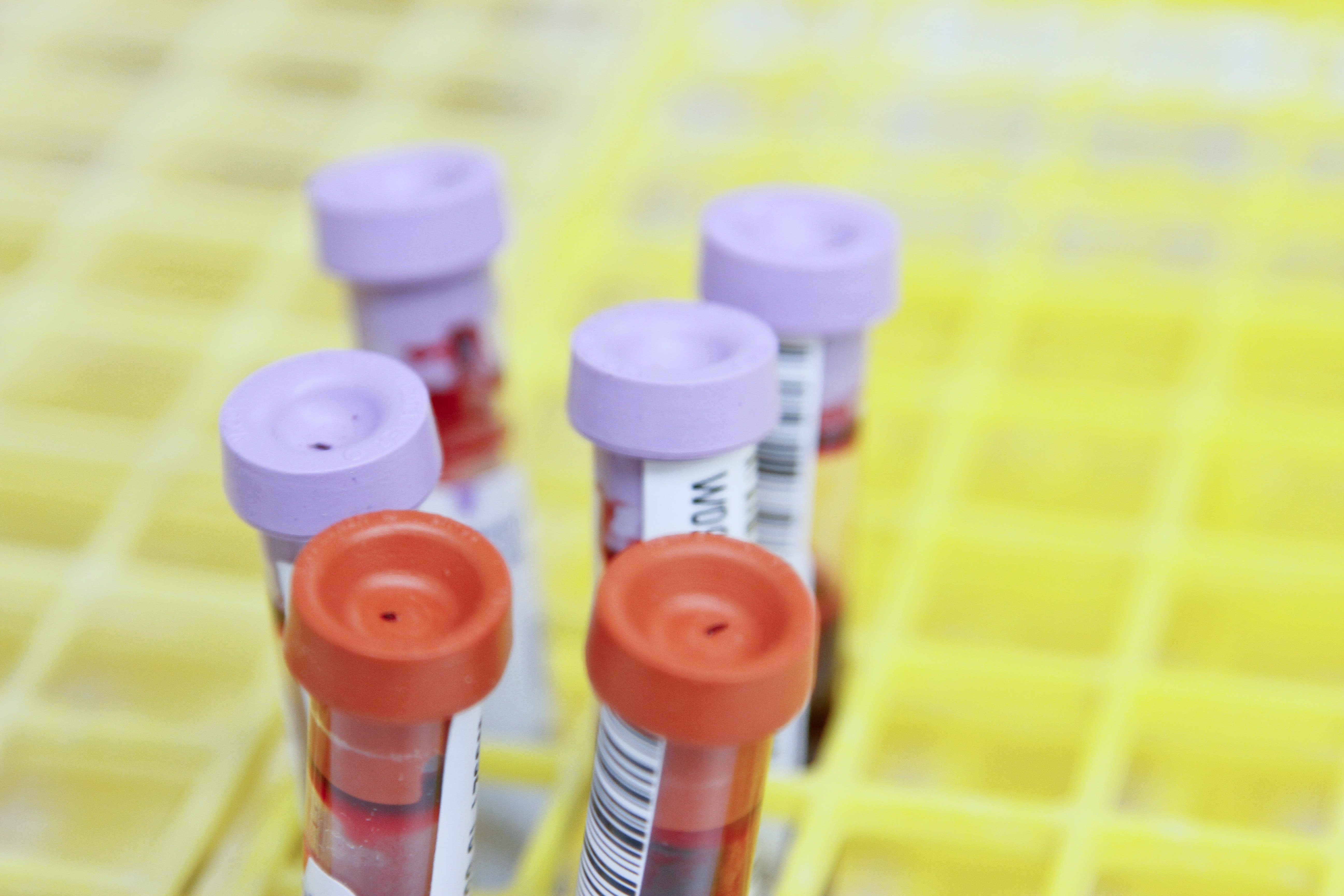Champions Oncology, Inc. (NASDAQ:CSBR) Q2 2023 Earnings Call Transcript - Vimarsana News