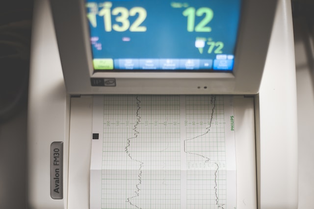 IRadimed Corporation (NASDAQ:IRMD) Q4 2022 Earnings Call Transcript - Vimarsana News